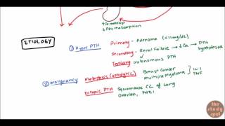 Hypercalcemia for USMLE Step 1 and USMLE Step 2 [upl. by Jaynell]