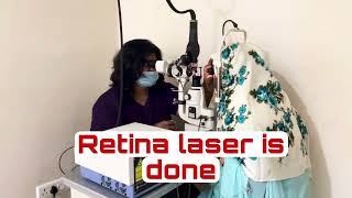 How is RETINA LASER done lasereyesurgery retinalaser [upl. by Aigil998]