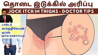 தொடை இடுக்கில் அரிப்பு நீங்க  jock itch dark skin spots black patches removal home remedies karthik [upl. by Hendrick557]