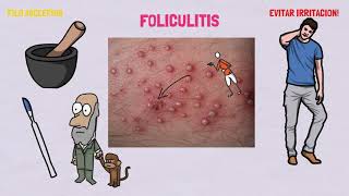 TRATAMIENTO PARA LA FOLICULITIS [upl. by Fredi502]