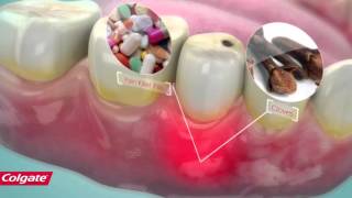 How Colgate Pain Out Works [upl. by Merl400]