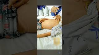 6 Years old Boy Chest Percussion in Pediatrics medical Chest assessment [upl. by Fish]