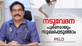 നടുവേദന മാറാൻ ഏറ്റവും എളുപ്പ മാർഗം  Back Pain Treatment in Malayalam Health Tips [upl. by Starlin911]