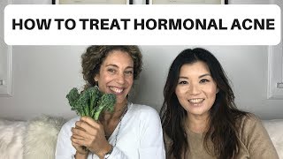 Natural Therapies to Prevent and Treat Hormonal Acne [upl. by Bernelle]