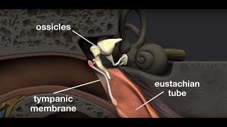 ENT  3D  Ear 3  Diseases of middle ear part 1 [upl. by Freeborn970]