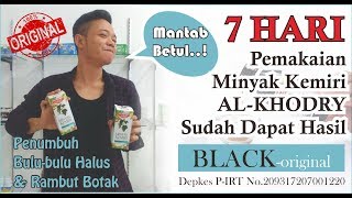 MANTAB BETUL  7 HARI Pemakaian MINYAK KEMIRI AL KHODRY Sudah Mendapatkan HASIL [upl. by Harrat]