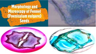 Morphology and Microscopy of Fennel Foeniculum vulgare Miller Seeds [upl. by Christan]