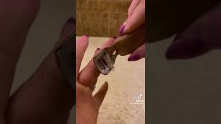 Fingertip maintenance with palmoplantar keratoderma hand callus EPPK  Apr 8 2023 [upl. by Ankeny]