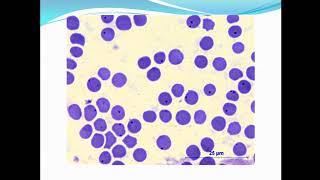 Rickettsial diseasesAnaplasmosis and Q fever ppt [upl. by Pretrice]