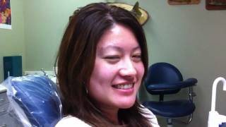 Dr Ben Fong Invisalign Testimonial Improving Overbite  Tracy [upl. by Black633]