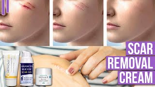 7 Best Scar Removal Cream  Scar Treatment That Actually Works [upl. by Ros457]