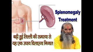 बढ़ी हुई तिल्ली की समस्या से यह उपाय दिलाएगा निजात  Enlarged Spleen Treatment in Ayurveda [upl. by Chaworth]