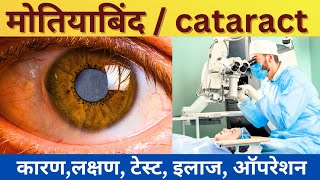 आँखों में मोतियाबिंद का कारण लक्षण ऑपरेशन cataract in hindimotiyabindh ka operations [upl. by Troy467]