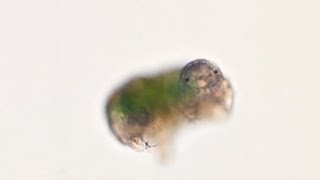 Water bears The toughest microanimal on the planet [upl. by Pedrick]