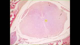 Interneuron sensory neuron pseudounipolar neuron ependymal cells satellite cells Spinal cord amp g [upl. by Letney]