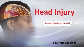 Head Injury  Extradural heamtoma Subdural hematoma [upl. by Joliet]