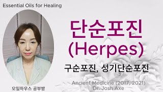 단순포진 구순포진 대상포진 구순단순포진 성기단순포진 수포진 Herpes [upl. by Ataynik]