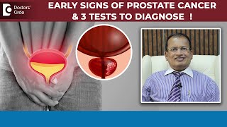 3 Tests to Diagnose Early Prostate Cancer  Prostate Cancer MonthDrNagarajaiah N  Doctors Circle [upl. by Esch]