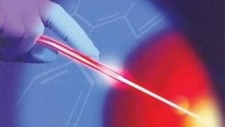 Krampfadern mit Laser behandeln [upl. by Aloeda]