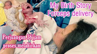 MY BIRTH STORY  FORCEPS DELIVERY  PERJUANGAN 36 jam MELAHIRKAN [upl. by Leviralc418]