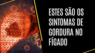 Cuidado Estes são os sintomas de gordura no fígado [upl. by Giacamo538]