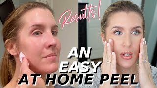 At Home Glycolic Acid Peel THAT WORKS  Over 40 Skincare [upl. by Hctub]