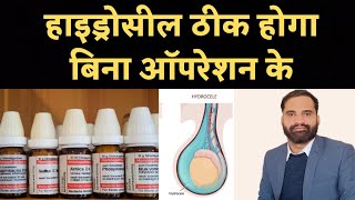 Hydrocele homeopathic medicine in hindi [upl. by Brantley]