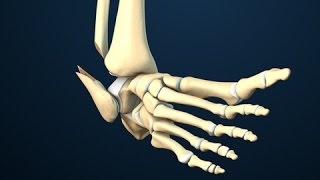 Ankle Fracture Surgery [upl. by Olympe]