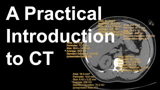 A Practical Introduction to CT [upl. by Moseley]