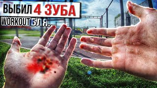 Выбил 4 Зуба упав с ТУРНИКА😰  AlexTuri [upl. by Annahsad992]