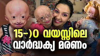 ചെറുപ്പത്തിൽ ബാധിക്കുന്ന അകാല വാർദ്ധക്യം ചികിത്സയില്ലാത്ത അപൂർവ രോഗം Adalia Rose Williams [upl. by Arat829]