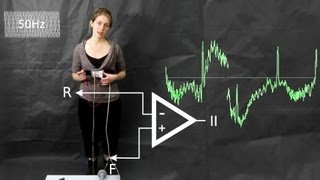 ECG common artefacts and how to avoid them [upl. by Barling]