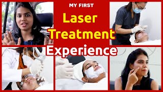 Laser Treatments in Face For Acne Scars  My Laser Resurfacing Experience [upl. by Ahsenod]