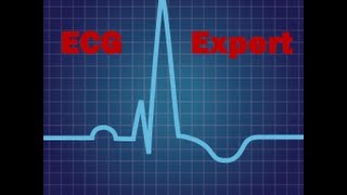 Interpret ECG changes in various Diseases How to Read ECG [upl. by Peyter]