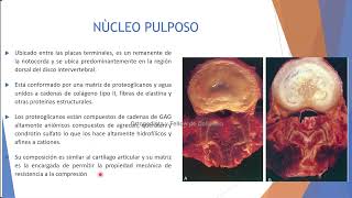 SPINE WEBINAR 60 HERNIAS DISCALES [upl. by Frans448]