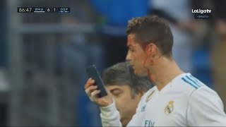 Cristiano Ronaldo Lesión en la cara  Real Madrid vs Deportivo La Coruna 71  La Liga 21012018 [upl. by Dincolo]