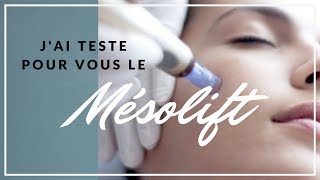 MESOLIFT VISAGE  jai testé [upl. by Nerhtak830]