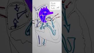 Tricuspid Atresia CHD Shorts [upl. by Theall551]