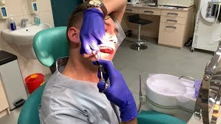 Self Extraction Wisdom Tooth 18 [upl. by Muriah]