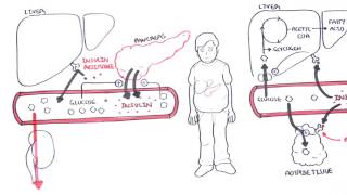 Diabetes Type II Pathophysiology [upl. by Anwahsad]