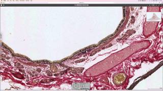 Histology of the lung [upl. by Elfrieda948]