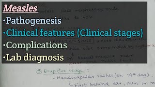 Measles  Pathogenesis  Clinical features  Complications  Lab diagnosis [upl. by Hanforrd547]