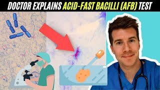 Doctor explains AcidFast Bacilli AFB test  Mycobacterium Tuberculosis TB [upl. by Itisahc]