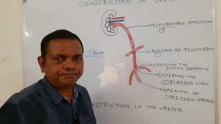 CONSTRICTION IN URETERURETERIC CONSTRICTION ANATOMY LECTURE OF ABDOMEN amp PELVIS [upl. by Kast]