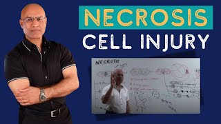 Necrosis Cell Injury  Apoptosis  General Pathology🦠 [upl. by Nilesoj]