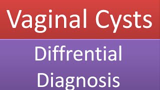 Vaginal Cysts and Swellings  Differential Diagnosis  Discussion [upl. by Petit]