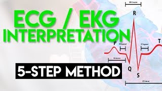 ECG Interpretation Made Easy  ECG EKG Interpretation Part 2 [upl. by Notnyw900]