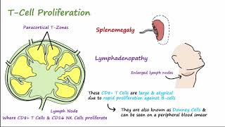 Mono  Pathophysiology Symptoms Diagnosis amp Treatment [upl. by Enelahs416]