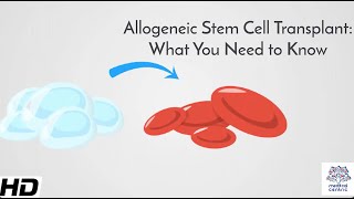 Allogeneic Stem Cell Transplant What You Need to Know [upl. by Zerla]