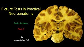 Picture Test in Neuroanatomy Brain Sections 2 [upl. by Aizek539]